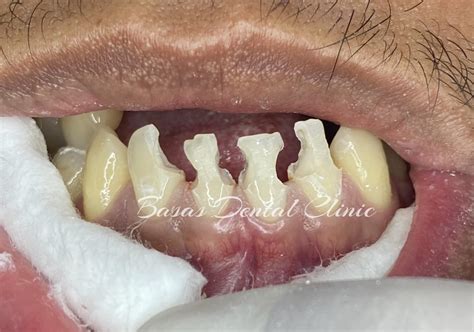 dental clinic olongapo|BASAS Dental Clinic .